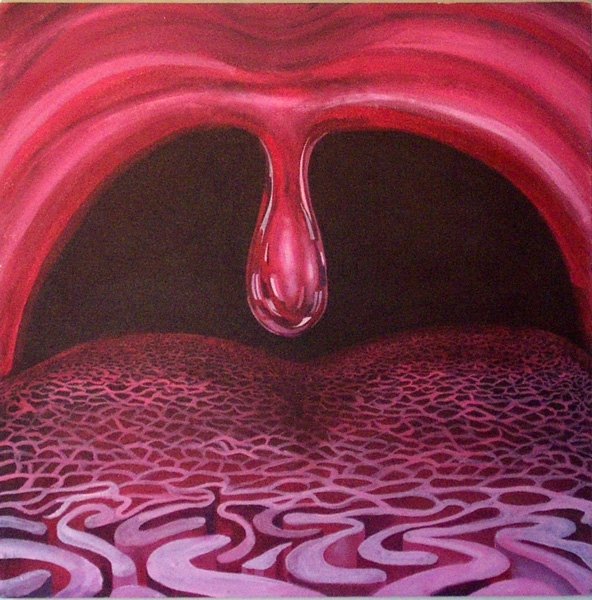 Halitosis